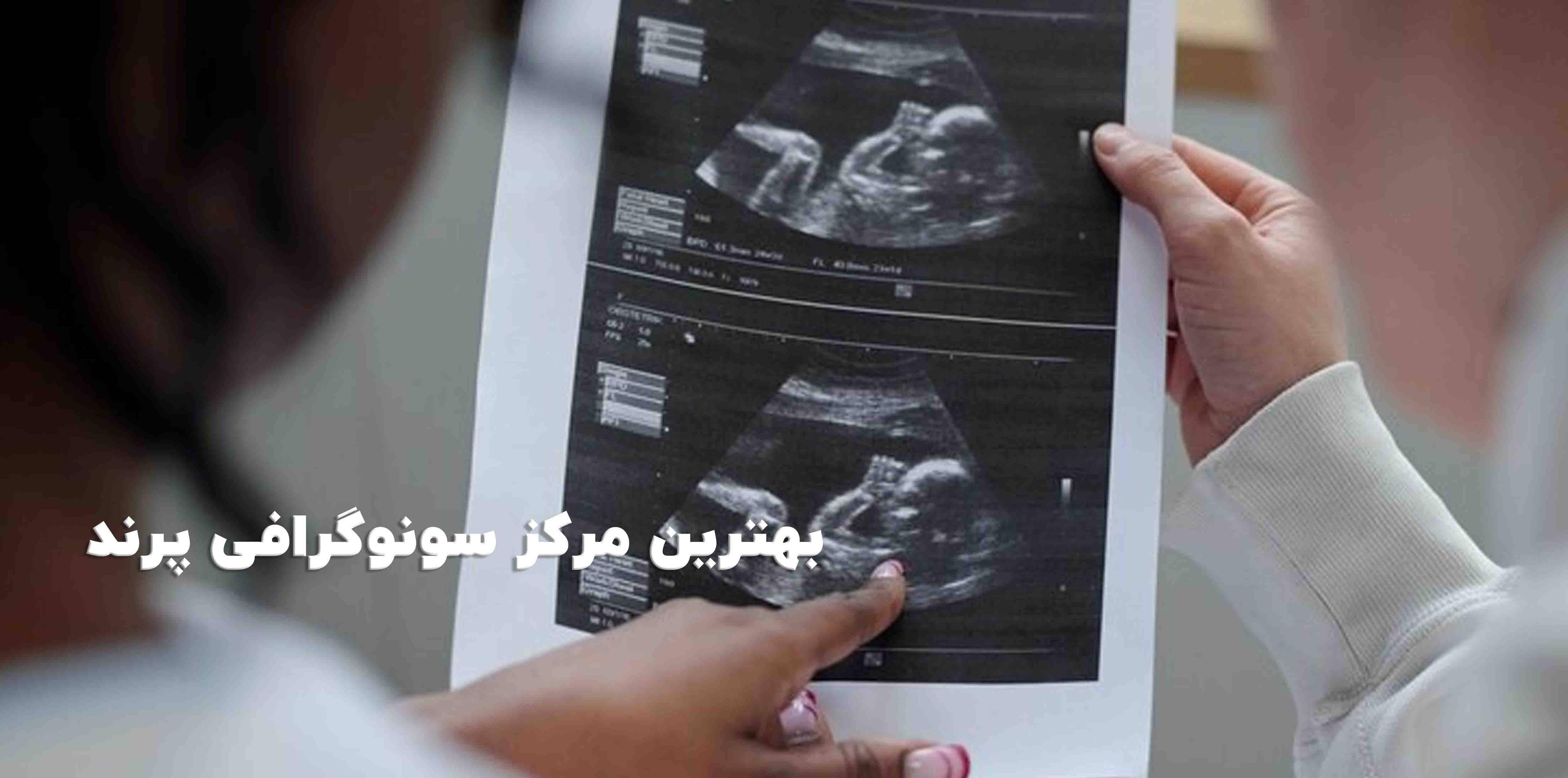 بهترین مرکز سونوگرافی پرند