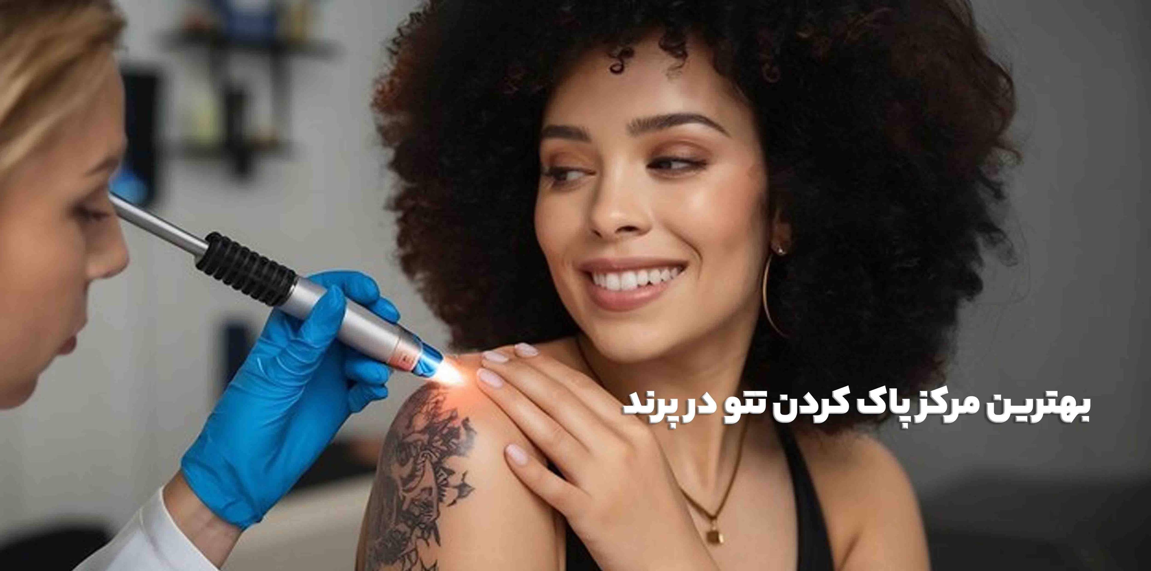 بهترین مرکز پاک کردن تتو در پرند